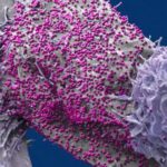 Bất ngờ khỏi HIV sau khi ghép tế bào gốc